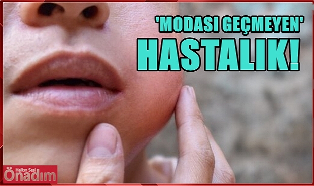Çocuklardan Yetişkinlere; ‘Modası Geçmeyen’ Hastalık!