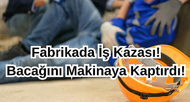 Fabrikada İş Kazası:Bacağını Makinaya Kaptırdı!