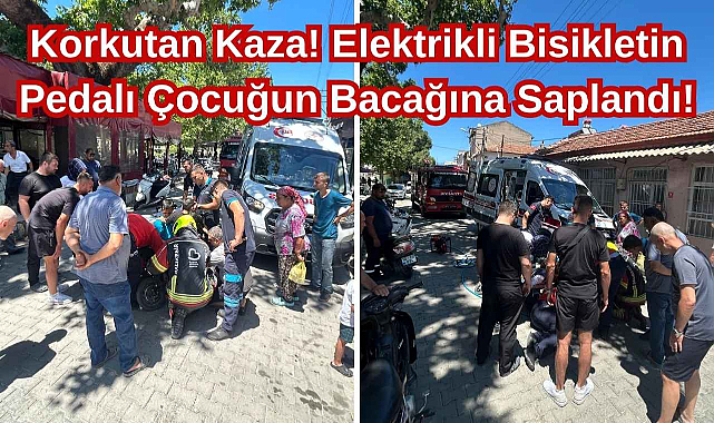 Korkutan Kaza! Elektrikli Bisikletin Pedalı Çocuğun Bacağına Saplandı!
