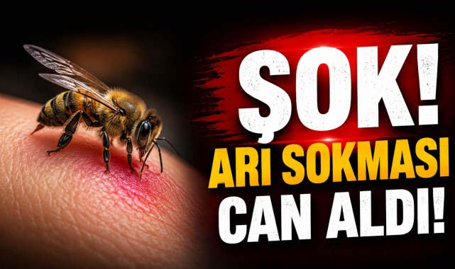 Şok! Arı Sokması Can Aldı!
